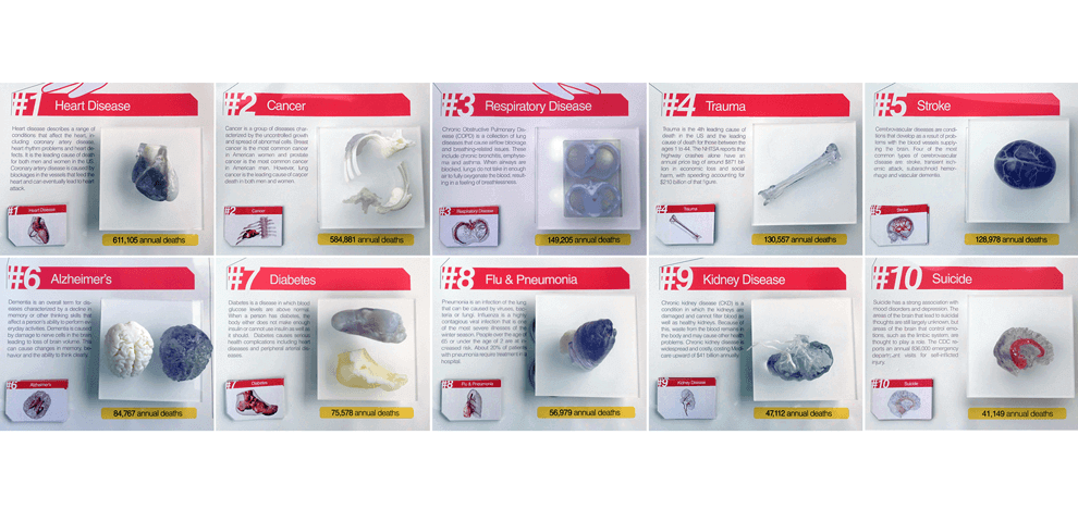 3d-printing-in-healthcare-4 3d-printing-in-healthcare-4